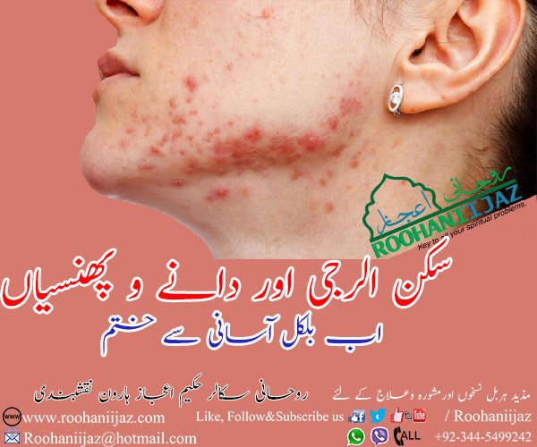 RIFB skin allergy aur daany o phinsioun k leye herbal nuskha